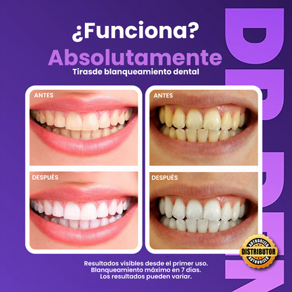 TIRAS DE BLANQUEAMIENTO- DR.DENTAL