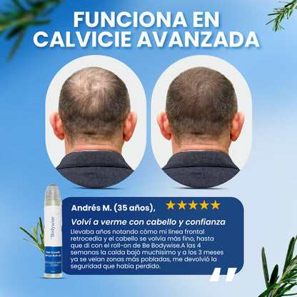 Be Bodywise para la calvicie